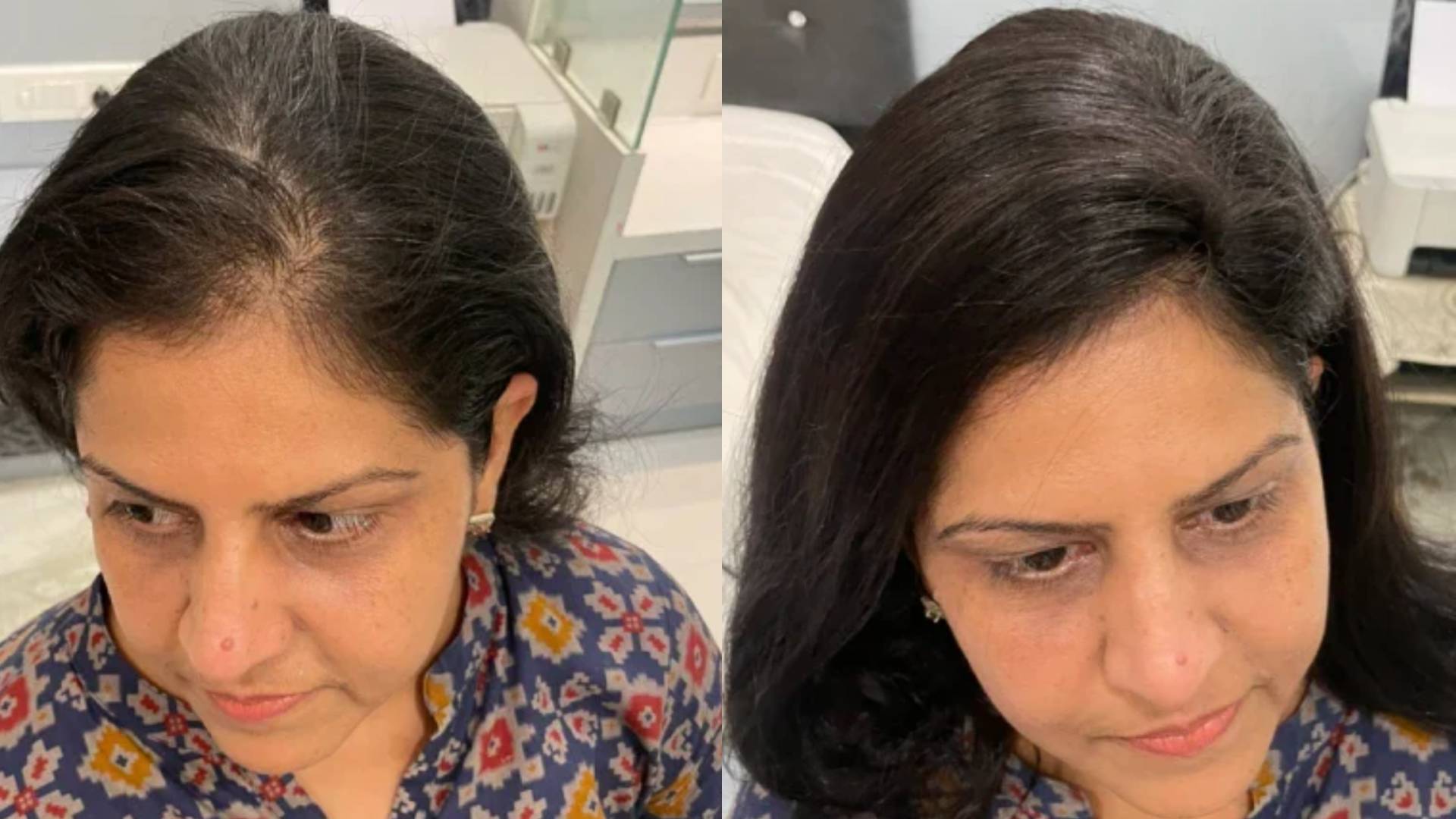 Woman with undetectable premium human hair wig by Beaumonde