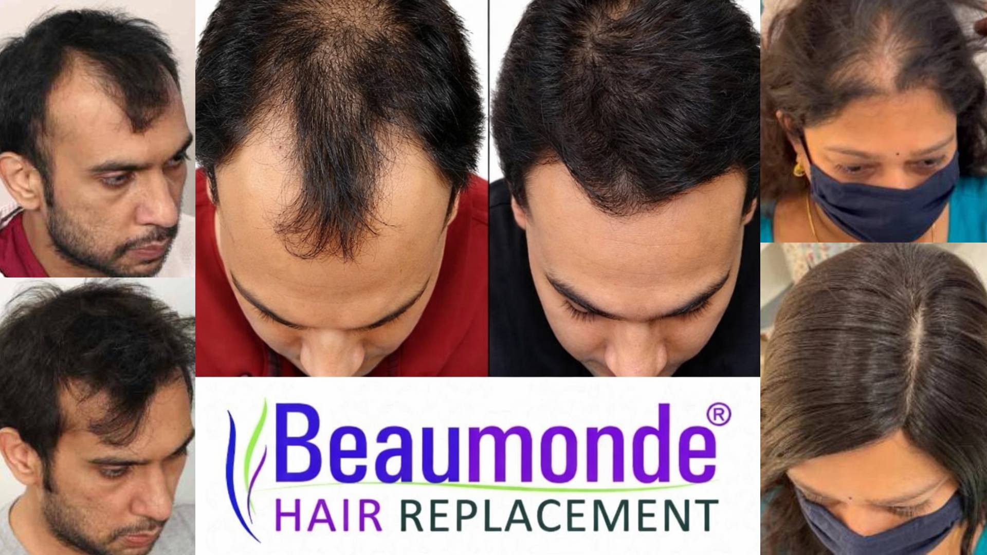Confident hair restoration client