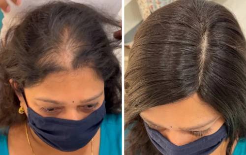 Women's Hair